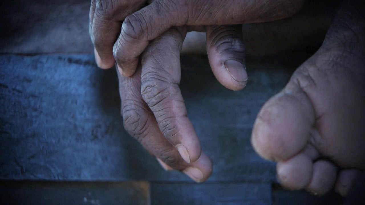 Weathered hands of a farmworker resting on wood